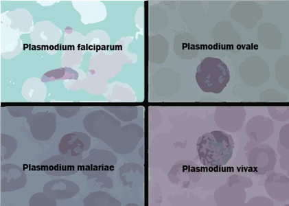 four different types of Plasmodium