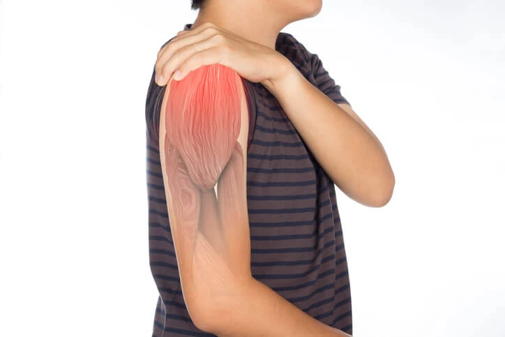 Muscle-weakness Muscle-weakness